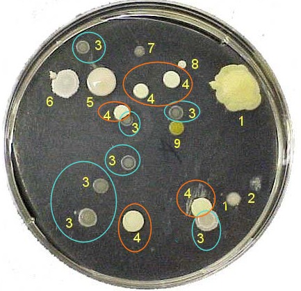 کلونی باکتری ها در پلیت