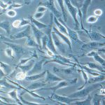 خصوصیات مورفولوژیک سلول ها در آزمایش کشت سلولی