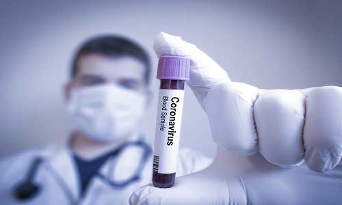 تشخیص آزمایشگاهی ویروس کرونا (Coronaviruses) امکانپذیر شد