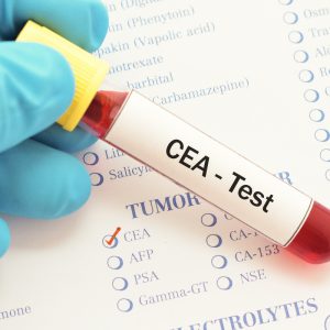 تست CEA