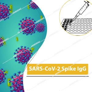 SARS COV 2 Spike IgG