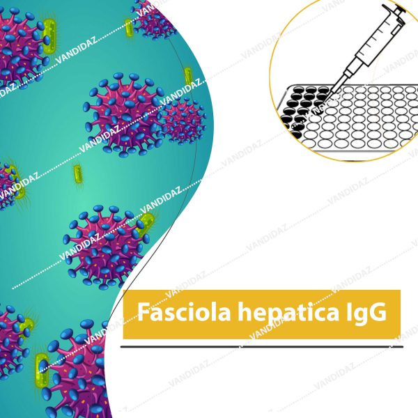تست Fasciola hepatica IgG
