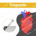 کیت الایزا تروپونین (cTnI) – (cTnT) – (cTnC)