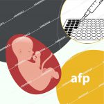 کیت الایزا AFP