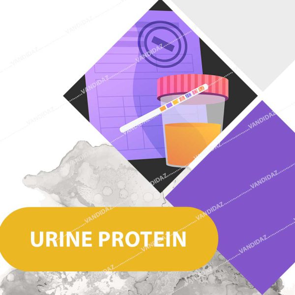 پروتئین ادرار urine-protein