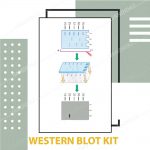 کیت وسترن بلات