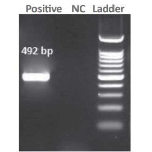 خرید Helicobacter pylori DNA