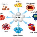 CRP چیست و چرا تست آن مهم است؟