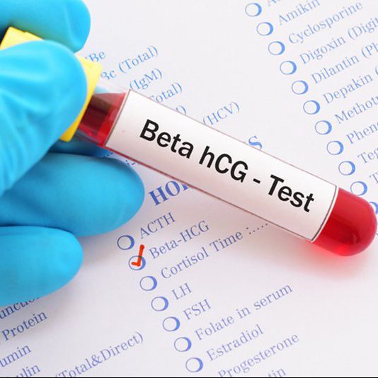 لوله خونگیری برگه آزمایش تست بتا HCG