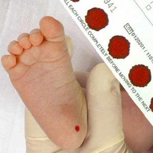 لکه خون واتمن برای تست غربالگری نوزادان