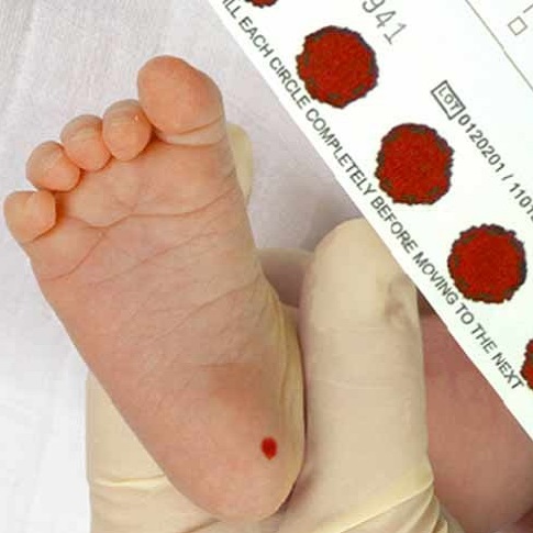 لکه خون واتمن برای تست غربالگری نوزادان